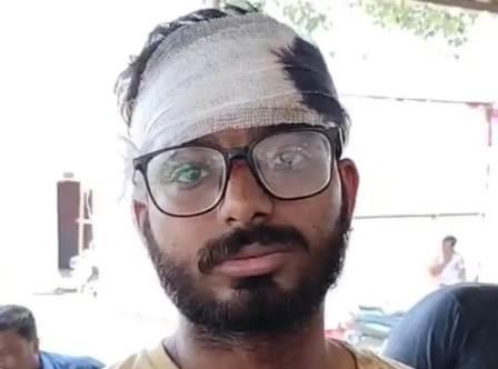 हाथरस के भाजपा नेता व पूर्व चेयरमैन के पुत्र के साथ मारपीट, जन्माष्टमी के चंदे को लेकर हुई थी कहासुनी, नामजदों ने घेरकर पीटा, किया लहू-लुहान