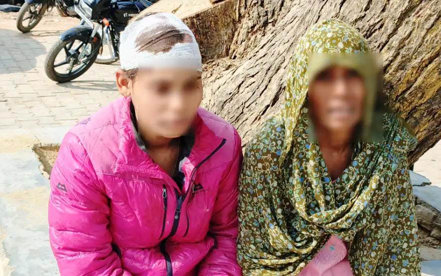 मामूली कहासुनी के बाद मां-बेटी से मारपीट, पड़ोसियों ने लाठी-डंडों से हमला कर लहू-लुहान किया, पुलिस से शिकायत