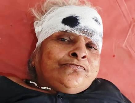 सादाबाद : सड़क हादसे में वृद्धा घायल, तेज रफ्तार बाइक ने मारी टक्कर