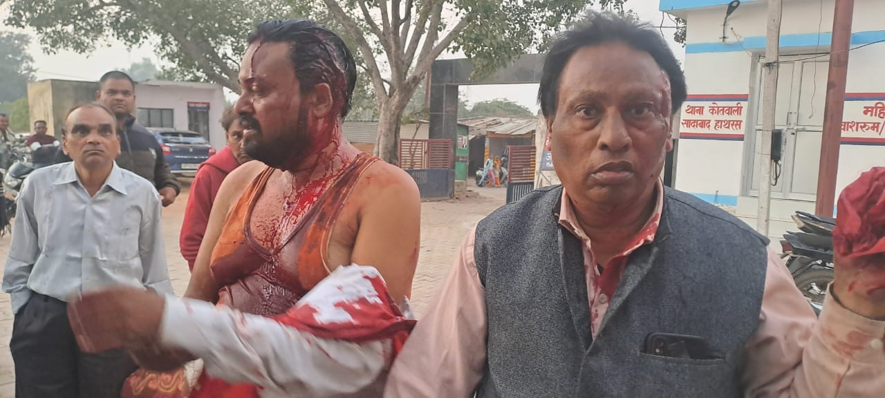 उधारी के रुपए मांगने पर अधिवक्ता से मारपीट, पिता-पुत्र गंभीर हालत में आगरा रेफर, पुलिस जांच में जुटी