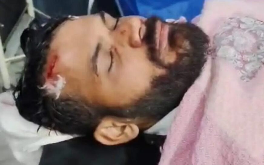 दूध के रुपयों को लेकर दो पक्षों में हुआ झगड़ा, मारपीट में पिता-पुत्र घायल, पुलिस ने मेडिकल कराया