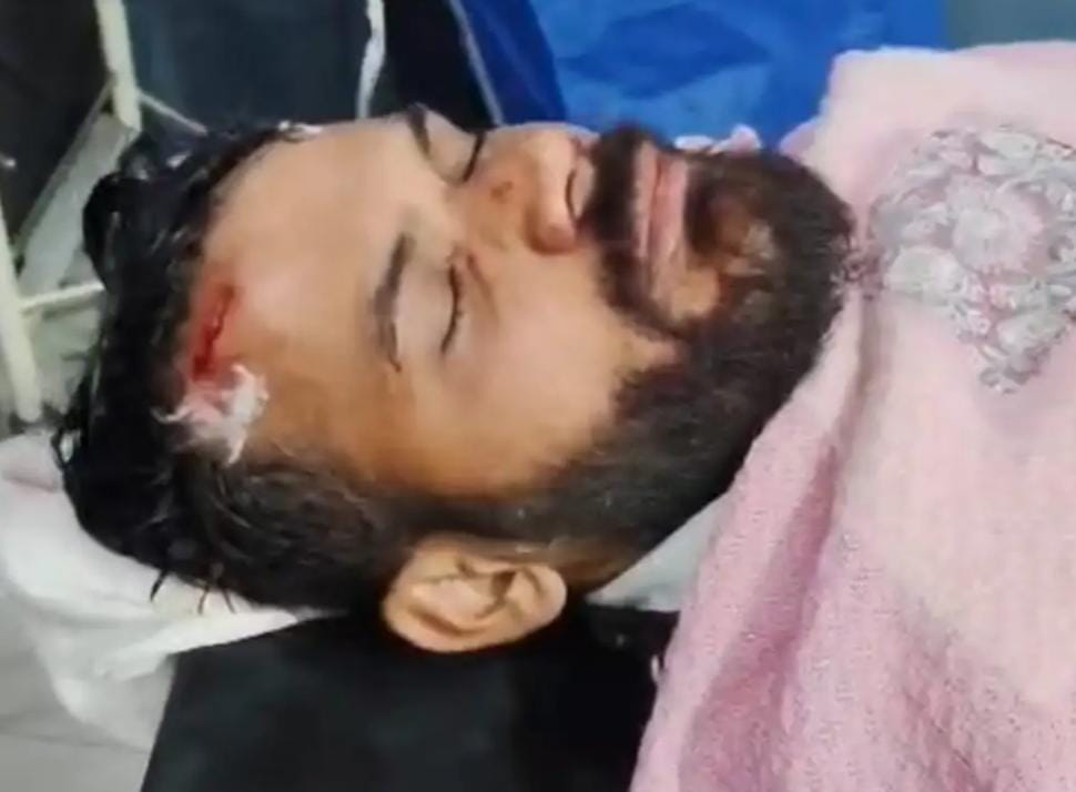 दूध के रुपयों को लेकर दो पक्षों में हुआ झगड़ा, मारपीट में पिता-पुत्र घायल, पुलिस ने मेडिकल कराया