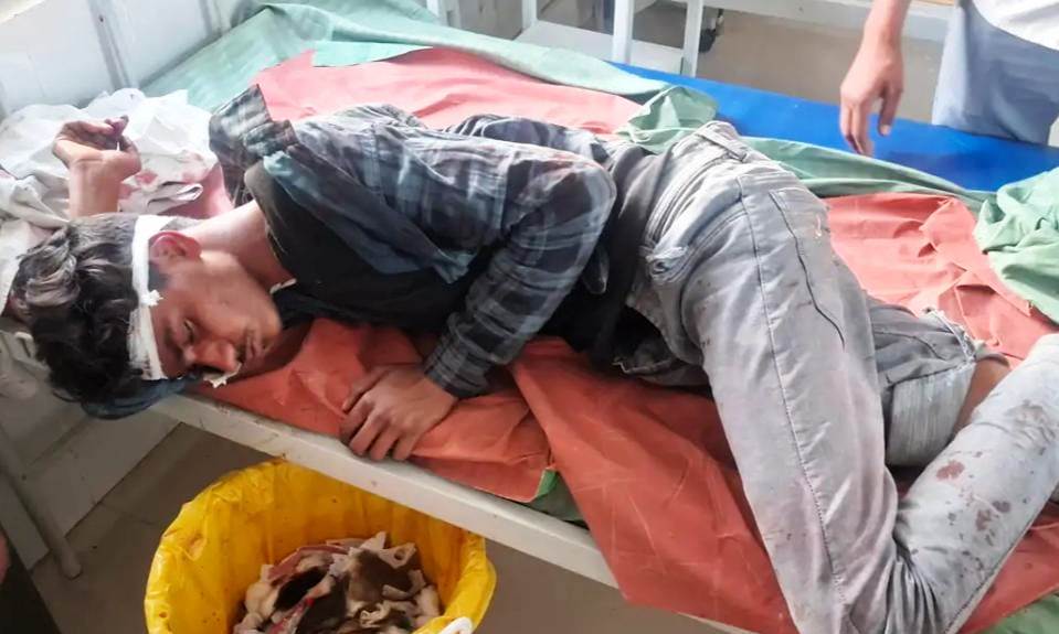 सड़क हादसों में छात्र सहित दो घायल, सहपऊ क्षेत्र में हुई दोनों सड़क दुर्घटनाएं, दोनों घायल रेफर