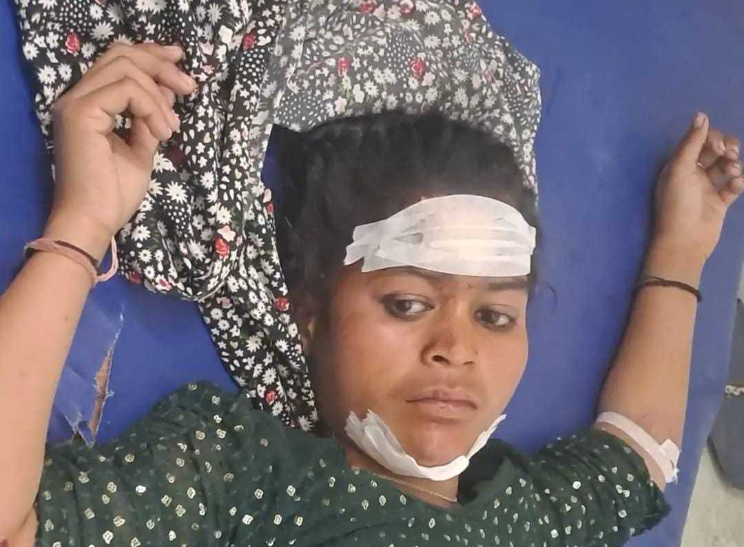 सादाबाद : तीसरी मंजिल से गिरी बालिका, मलबे में दबे अन्य लोग