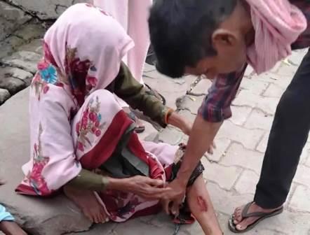 सादाबाद : पागल कुत्ते के हमले में वृद्धा घायल, गांव मड़नई में पागल कुत्ते का आतंक, अब तक दर्जनों लोगों को बना चुका है शिकार