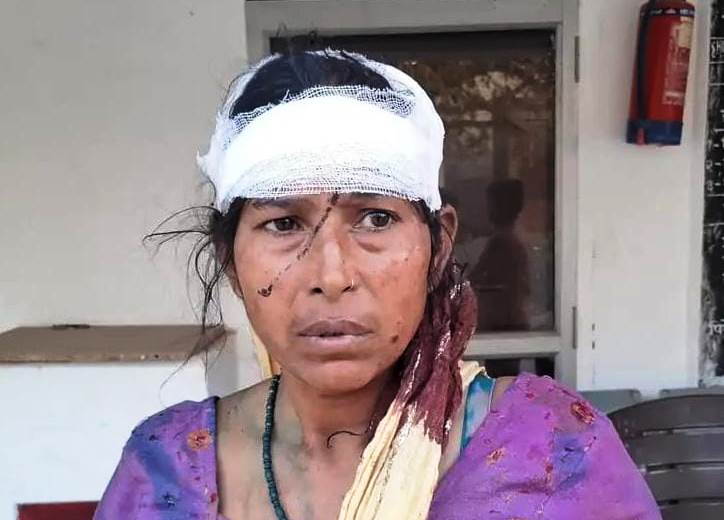 सादाबाद : बच्चों के विवाद में महिला का सिर फटा, महरारा गांव में बच्चों को लेकर भिड़े दो पक्ष, पुलिस ने कराया मेडिकल