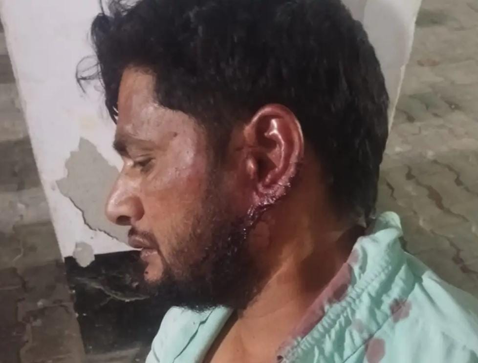 सादाबाद : सचिवालय की चाबी को लेकर विवाद, पंचायत सहायक के पति को मारपीट कर घायल करने का आरोप, मुकदमा दर्ज