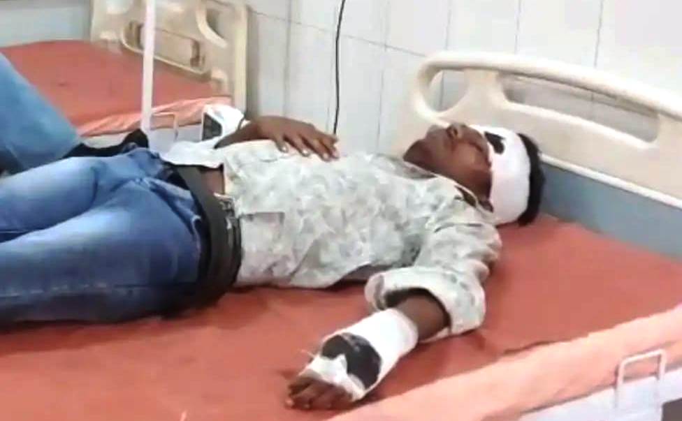 सादाबाद : बाइक फिसलने से दो युवक घायल, काम खत्म कर अपने गांव लौट रहे थे बाइक सवार युवक