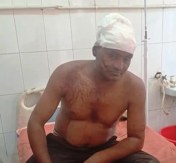 सादाबाद : रास्ता रोकने का विरोध करने पर मारपीट, पीड़ित ने कोतवाली पुलिस को दी शिकायत