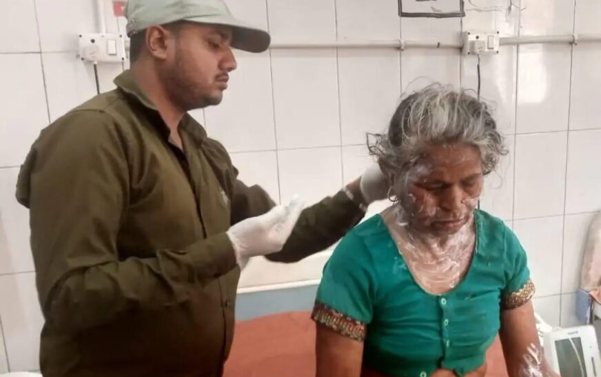 सादाबाद : चिप्स बनाते समय महिला झुलसी, गर्म पानी उठाते समय पैर फिसल जाने से हुई घटना