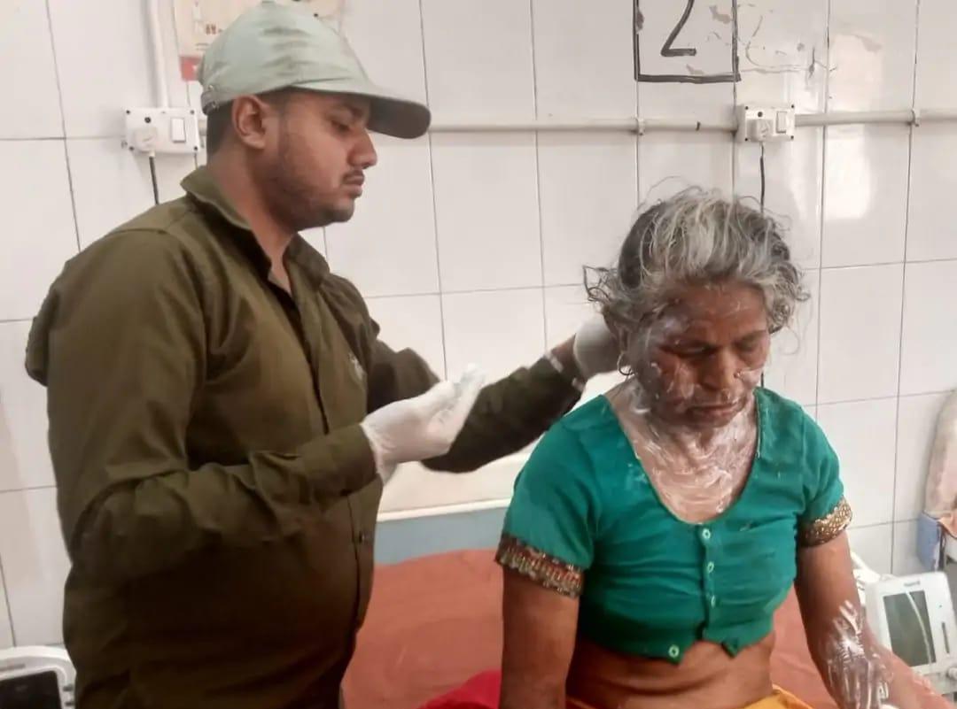 सादाबाद : चिप्स बनाते समय महिला झुलसी, गर्म पानी उठाते समय पैर फिसल जाने से हुई घटना