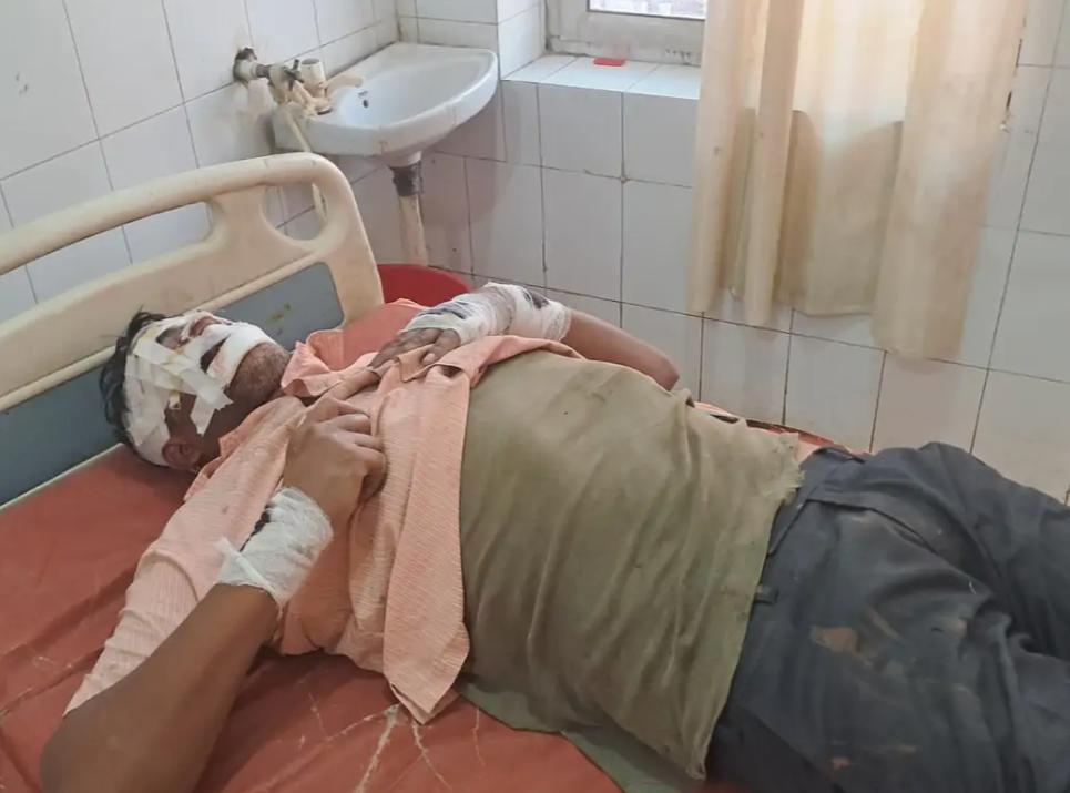 सड़क हादसों में बाइक सवार तीन घायल, हाथरस और मुरसान रोड पर हुई अलग-अलग दुर्घटनाएं