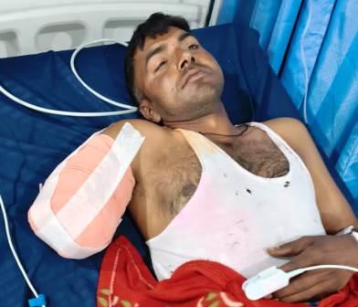 गेहूं निकालते समय कटर की चपेट में आया युवक, शरीर से कटकर अलग हुआ हाथ