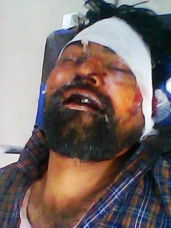 काम के बहाने घर से बुलाकर युवक को बेरहमी से पीटा, अचेत अवस्था में अस्पताल छोड़कर भागे आरोपी, हालत गंभीर, अलीगढ़ में चल रहा उपचार