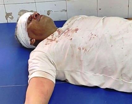 गंगा स्नान कर लौट रहे श्रद्धालुओं की बोलेरो को कंटेनर ने मारी टक्कर, छह से अधिक घायल