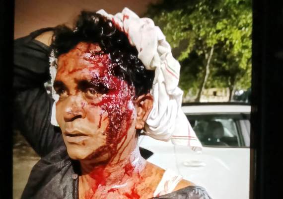 नशेड़ी कर्मचारी को काम से हटाना पड़ा भारी, दबंगों ने बैंड संचालक और भतीजे पर किया जानलेवा हमला, सिर फटने से युवक गंभीर घायल