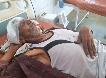 सादाबाद : पुरानी रंजिश को लेकर परिवार के साथ मारपीट, पुलिस ने घायलों का मेडिकल कराया, गांव में पुलिस बल तैनात