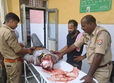 सादाबाद: सड़क दुर्घटना में बाइक सवार घायल, सामने आ रहे वाहन से बचने के प्रयास में कटीले तारों में गिरा बाइक सवार