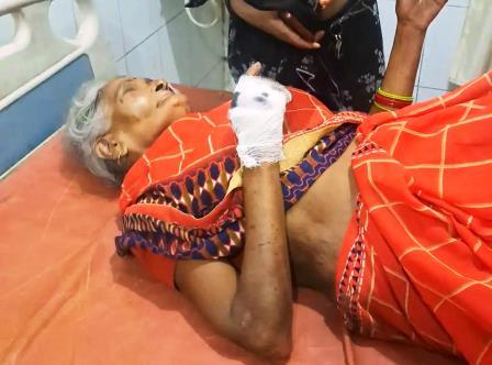 सादाबाद : सड़क हादसे में वृद्धा सहित तीन घायल  जैतई मोड़ के निकट बाइक सवारों को कार ने मारी टक्कर
