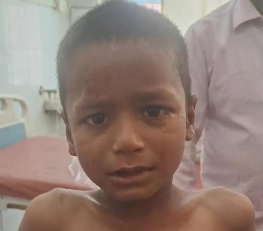 सादाबाद : ई रिक्शा की टक्कर से बालक घायल  मथुरा रोड पर हुआ हादसा, स्थानीय लोगों ने सीएचसी में कराया भर्ती