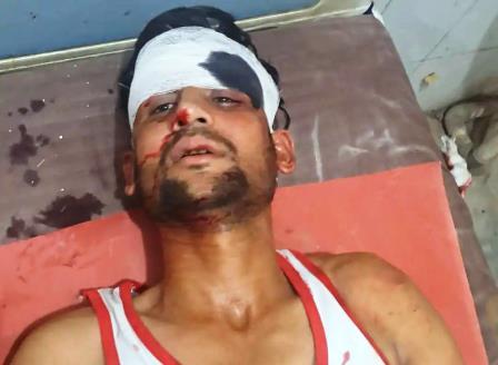 सादाबाद : ट्रक की टक्कर से युवक घायल