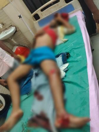 मुरसान : तेज रफ्तार बाइक की टक्कर से युवक गंभीर घायल