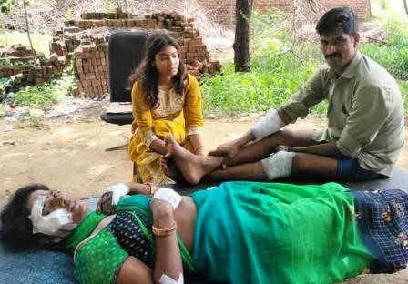 सादाबाद : सड़क हादसे में बाइक सवार दंपत्ति घायल, राया रोड पर गांव कजरौठी के निकट कुत्ते को बचाने के प्रयास में फिसली बाइक