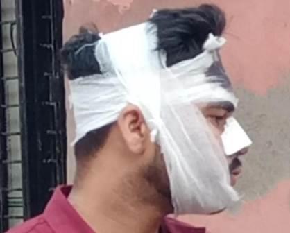 सादाबाद : बाइक फिसलने से युवक, महिला घायल, जलेसर रोड पर बाइक के सामने बंदर, कुत्ता के आ जाने से हुआ हादसा