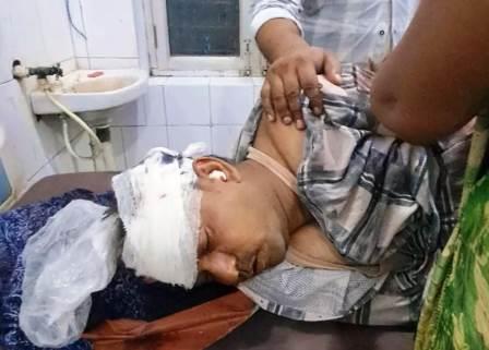 सादाबाद : नीलगाय से टकराई बाइक, सवार घायल, महावन जा रहे थे बाइक सवार पति पत्नी, जारऊ लिंक मार्ग हुई घटना
