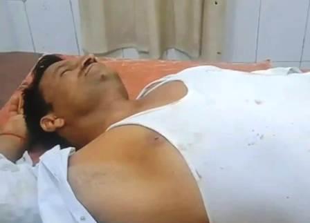 सादाबाद : सड़क हादसे में किसान की हड्डी टूटी, राया रोड पर पिकअप चालक ने गलत दिशा में जाकर बाइक सवार को मारी थी टक्कर