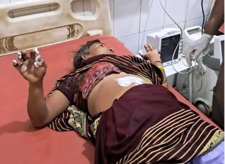 सादाबाद : ट्रांसफार्मर में धमाका, एक की मौत, क्षेत्र के गांव कुंजलपुर में हुई घटना, दो अन्य लोग झुलसे, धमाके के बाद टूटे तार की चपेट में आये तीन लोग