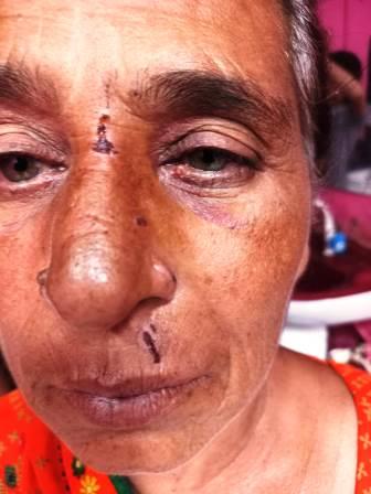 घर में घुसकर बुजुर्ग महिला से मारपीट और जेवर खींचने का आरोप, एसपी से कार्रवाई की गुहार