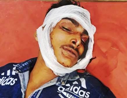 सादाबाद : दुर्घटनाओं ने बाइक सवार तीन घायल, एक गम्भीर घायल को किया गया आगरा रेफर, अलग अलग क्षेत्रों में हुई दुर्घटना
