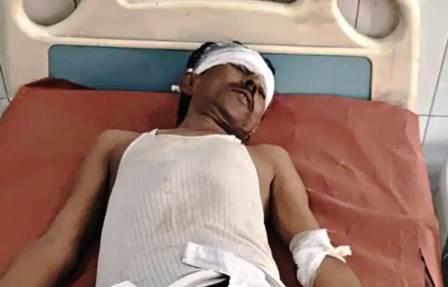 सादाबाद : सड़क हादसे में बाइक सवार दो घायल, आगरा रोड जलेसर रोड पर हुई सड़क दुर्घटनाएं, एक घायल रेफर