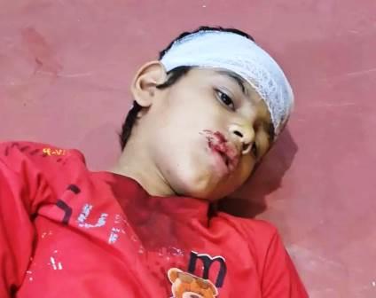 सादाबाद : सीढ़ियों से गिरकर बच्चा घायल, सीढ़ियों के निकट खेलते समय बच्चे का बिगड़ा संतुलन
