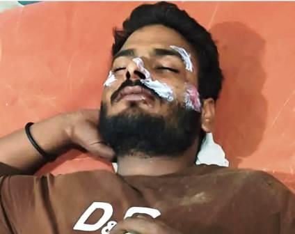 सादाबाद : अज्ञात वाहन की टक्कर से बाइक सवार घायल, मथुरा रोड पर गांव टिकैत के निकट हुई सड़क दुर्घटना