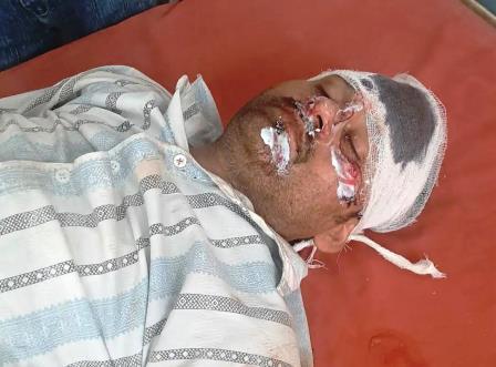 सादाबाद : कार की टक्कर से बाइक सवार घायल, आगरा रोड पर गांव ग़ुरसौटी के निकट हुई सड़क दुर्घटना